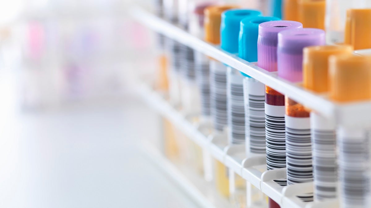 A row of human samples for analytical testing including blood, urine, chemistry, proteins,anticoagulants and HIV in lab